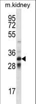 IHC-plus™ TLX1 / HOX11 Antibody (aa163-191)