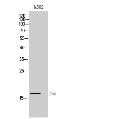 Polyclonal Rabbit anti-Human JTB / PAR Antibody (20-100 aa, N-terminal, WB)