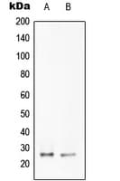 TNF Alpha Antibody (Internal)
