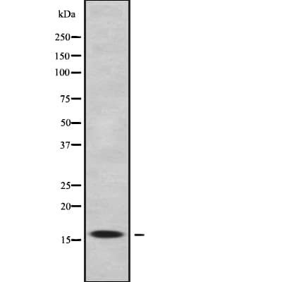 RPS17 / Ribosomal Protein S17 Antibody