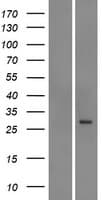 ABCC5 / MRP5 Protein (Over-Expression Lysate Myc-DDK (Flag))