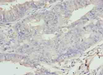 EPO / Erythropoietin Antibody