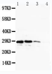 Polyclonal Rabbit anti-Human CUEDC2 Antibody (aa267-287, IHC, WB)