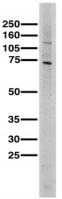 CACNB2 Antibody (clone S8b-1)