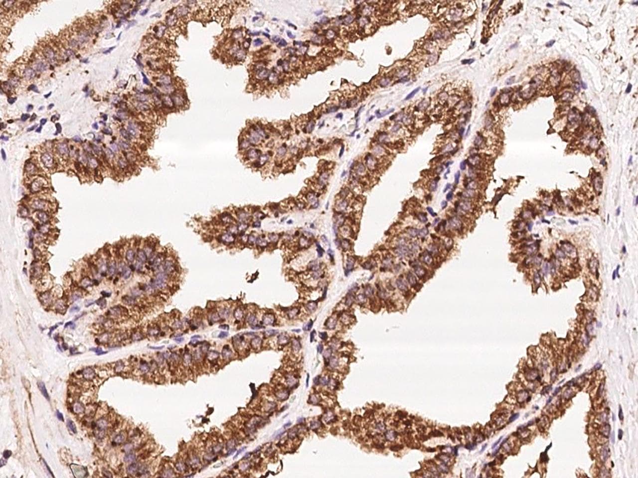 Polyclonal Rabbit anti-Human TUBA1A / Tubulin Alpha 1a Antibody (Preservative Free, IHC, IF, WB)