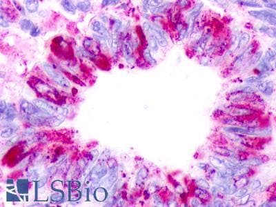 PathPlus™ Polyclonal Rabbit anti-Human GPR68 / OGR1 Antibody (C-Terminus, IHC)