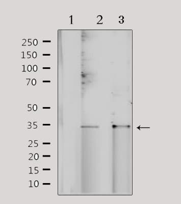 NRIP2 Antibody