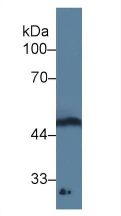 GDF11 / GDF-11 Antibody (clone C3)