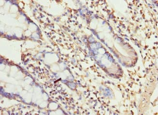 Polyclonal Rabbit anti-Human UGT3A2 Antibody (IHC)