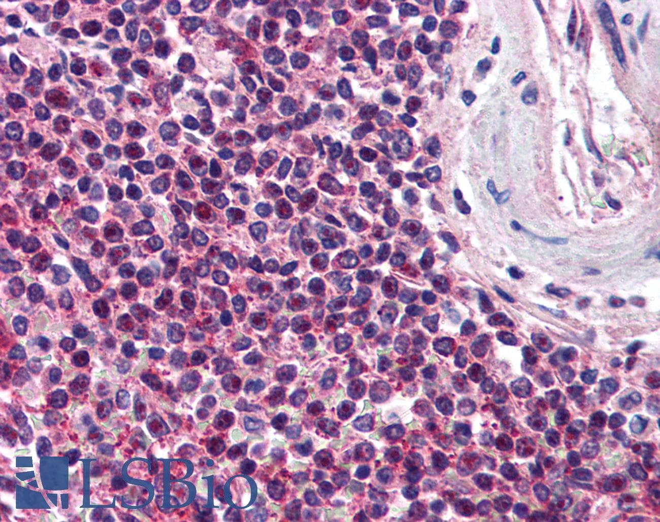 BHLHB2 / DEC1 Antibody (C-Terminus, DY488)