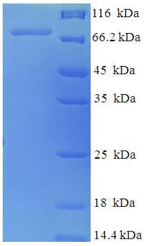 Human NXF3 Protein (Recombinant His-SUMO)