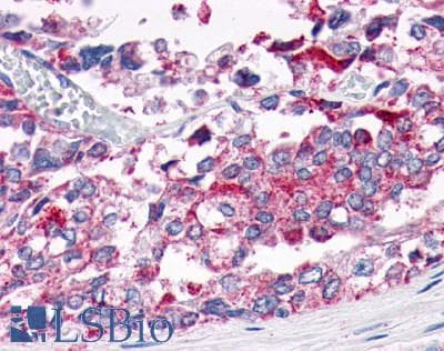 PathPlus™ Polyclonal Rabbit anti-Human GPER1 / GPR30 Antibody (Extracellular Domain, IHC, IF)