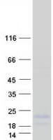 Human LYPD2 Protein (Recombinant Myc-DDK (Flag))