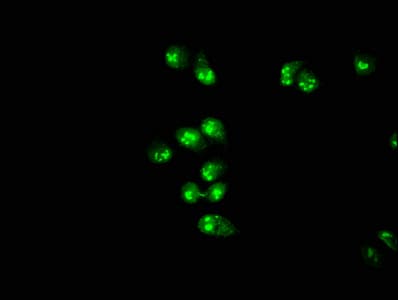 Polyclonal Rabbit anti-Human PRMT1 Antibody (IF)