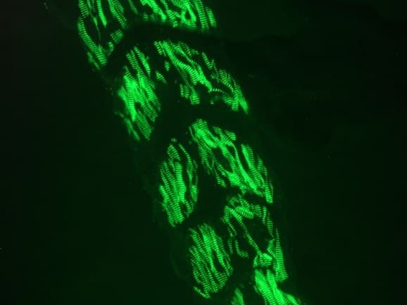 IHC-plus™ Monoclonal Mouse anti-Human Muscle Actin Antibody (clone HHF35, IHC, WB)