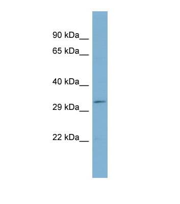 SYNE4 / C19orf46 Antibody (N-Terminus)
