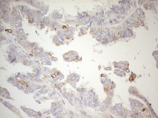 Monoclonal Mouse anti-Human GRN / Granulin Antibody (clone OTI3H6, aa327-593, IHC, WB)