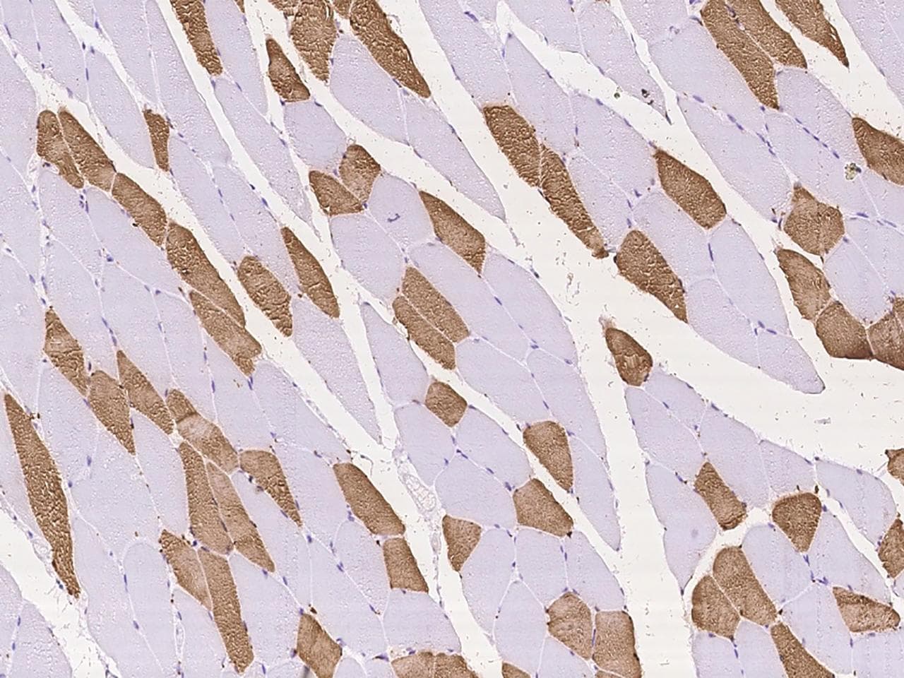 TNNI2 Antibody
