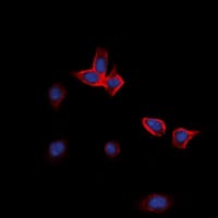 EPHA3 / EPH Receptor A3 Antibody (Internal)