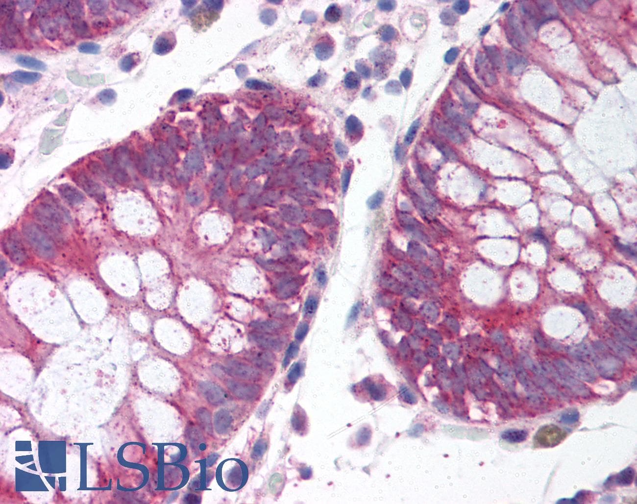 NIFK / MKI67IP Antibody (aa140-189)
