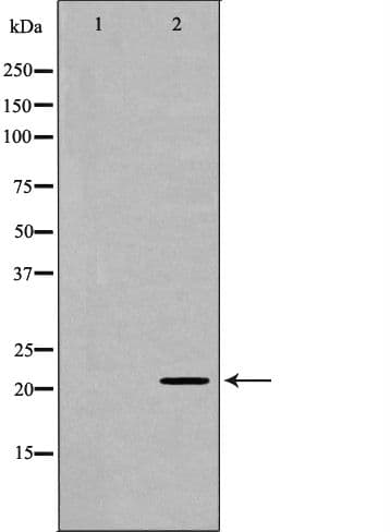 GLO1 / Glyoxalase I Antibody