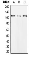 CLCN1 / CLC-1 Antibody (N-Terminus)