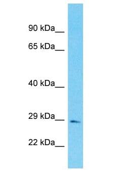 FAM118B Antibody (aa14-63)