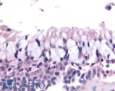 PathPlus™ Polyclonal Rabbit anti-Human OR6K3 Antibody (C-Terminus, IHC)