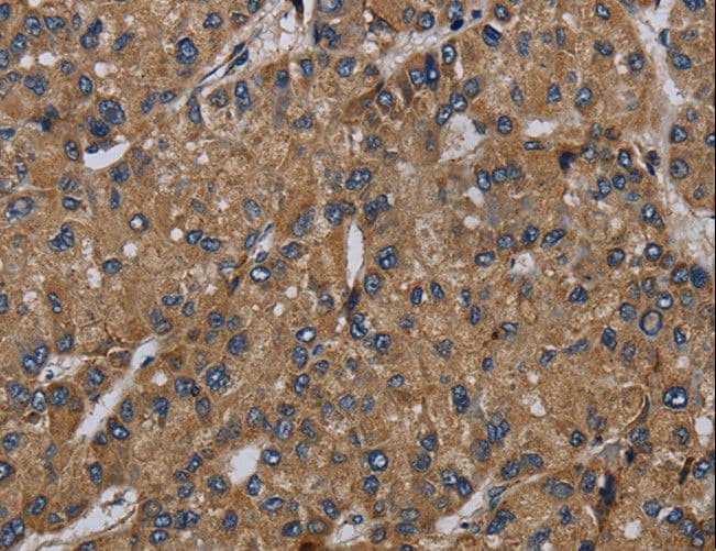 NDUFS6 Antibody