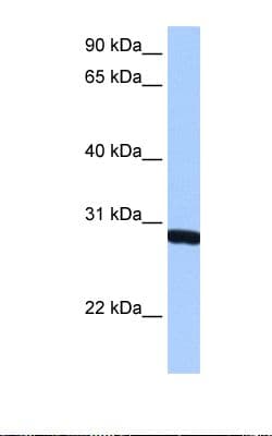 SMN1 Antibody (aa45-94, Biotin)