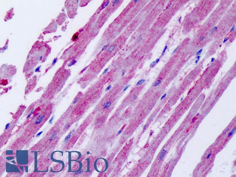 IHC-plus™ Polyclonal Rabbit anti-Human ACKR4 / CCRL1 / CCR11 Antibody (Cytoplasmic Domain, IHC)