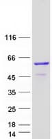 Human TCBE / KCS / HRD Protein (Recombinant Myc-DDK (Flag))