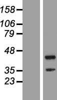 TTC23L / FLJ25439 Protein (Over-Expression Lysate Myc-DDK (Flag))