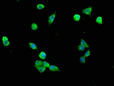 Polyclonal Rabbit anti-Human C5orf13 Antibody (IHC, IF)