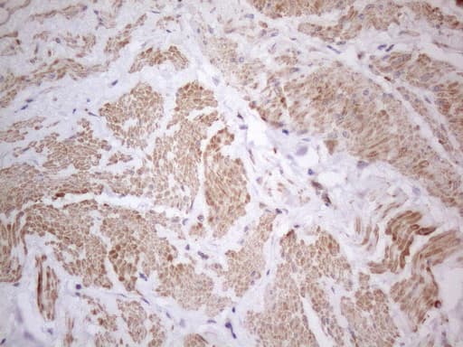 ATF1 Antibody (clone OTI7H3)