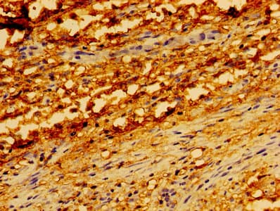 Polyclonal Rabbit anti-Human TRADD Antibody (IHC, IF, WB)