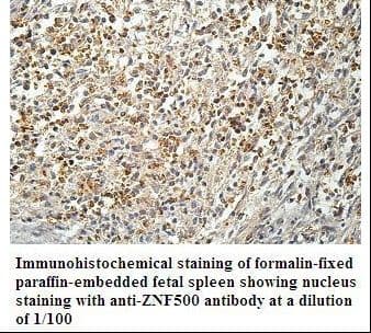 ZNF500 Antibody (aa50-255)