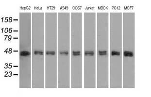 DAPK2 / DAP Kinase 2 Antibody (clone OTI1C5, Carrier-free)