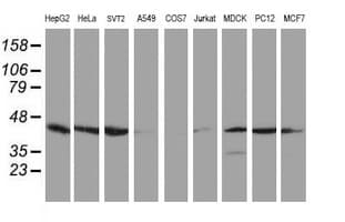 CRYZL1 Antibody (clone OTI1D9)