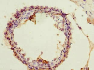 ACSS2 / ACAS2 Antibody