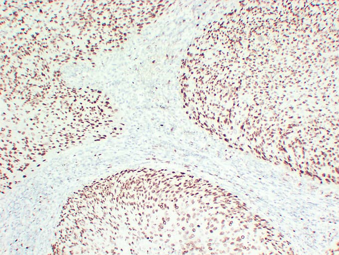 MCM2 Antibody (clone ABT-MCM2)