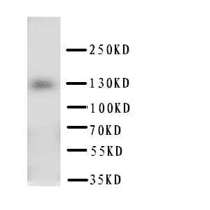 Polyclonal Rabbit anti-Human PTCH2 / Patched 2 Antibody (aa885-901, WB)