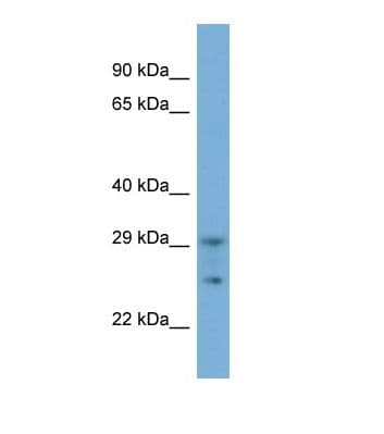 SPRYD5 Antibody (aa122-171)
