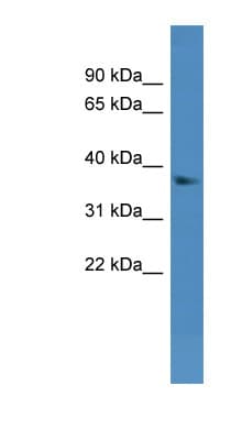 Polyclonal Rabbit anti-Mouse DHRS7 Antibody (aa51-100, WB)