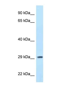 PPP1R3B Antibody (aa40-89)