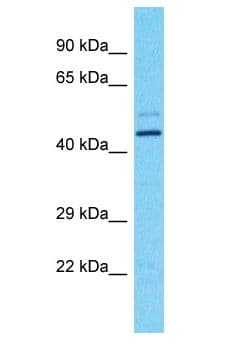 Polyclonal Rabbit anti-Human FOXD4L1 / FOXD5 Antibody (aa9-58, WB)
