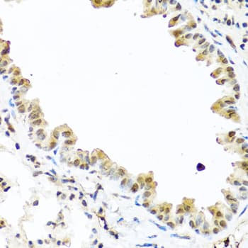 TET2 Antibody