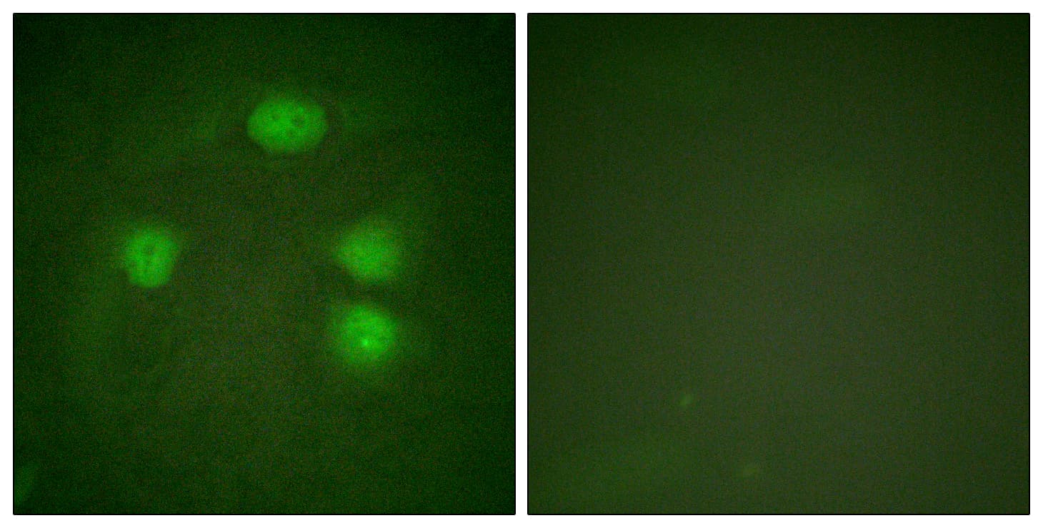 KCNJ3 / GIRK1 Antibody (aa151-200)
