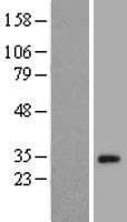 Human ZNF501 Protein (Over-Expression Lysate Myc-DDK (Flag))