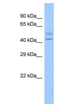 Polyclonal Rabbit anti-Human ZNF679 Antibody (aa136-185, WB)